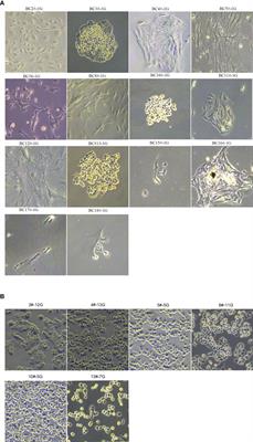 Patient-derived primary breast cancer cells and their potential for predicting sensitivity to chemotherapy